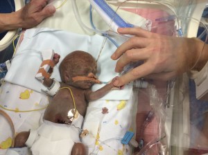 My almost-normal boy